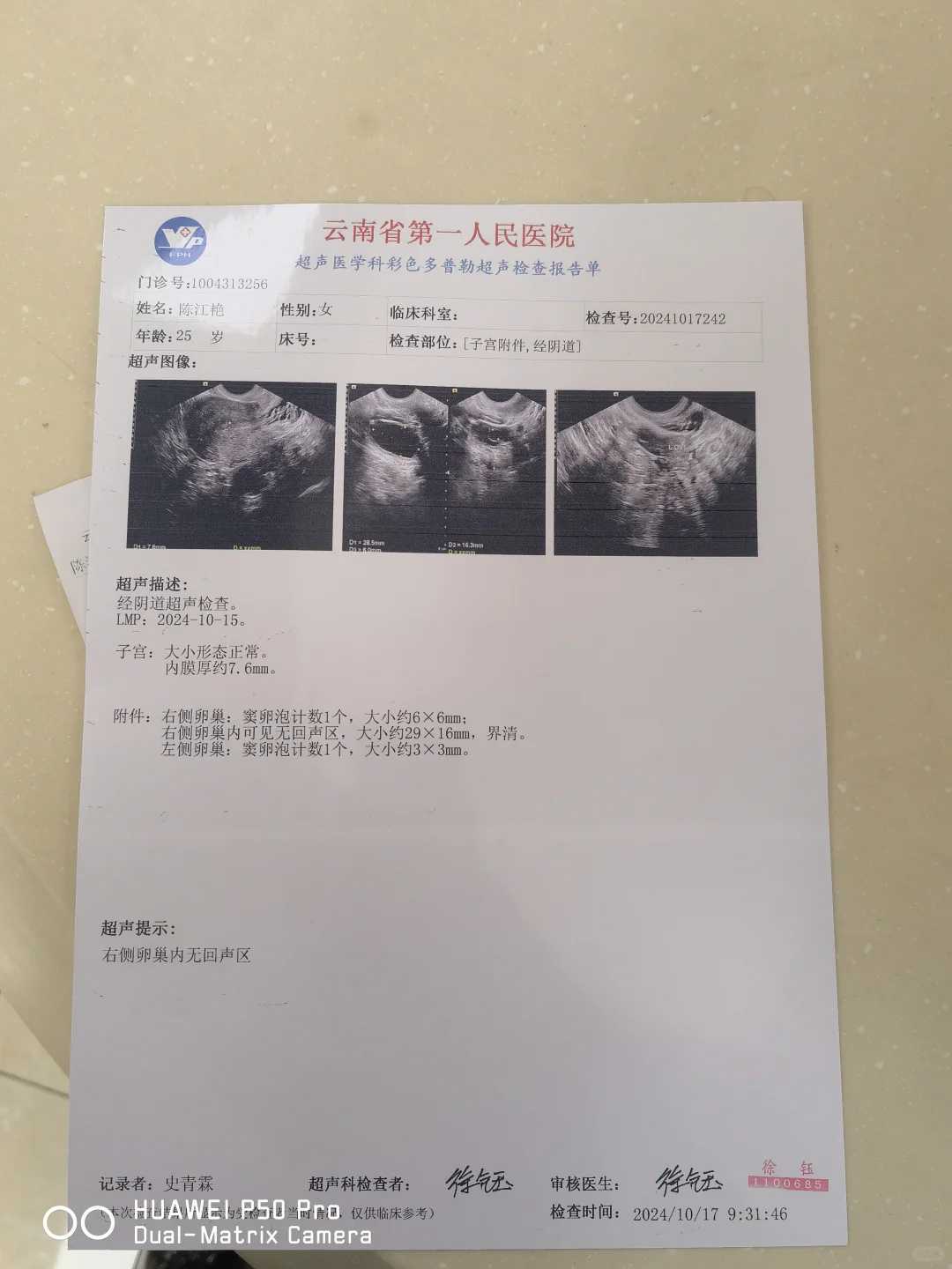 试管婴儿遗传学筛查关键要点与流程详解